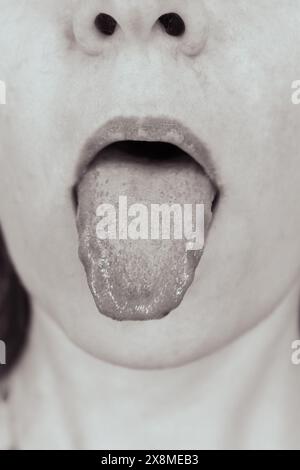 Frau mit offenem Mund, monochrom. Mädchenporträt zeigt Zunge, Nahaufnahme. Rachenkrankheit und Gesundheitsfürsorge. Frau Lippen und Mund. Zahnhygiene. Stockfoto