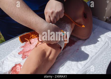 Der Sanitäter legt einen Tourniquet am Arm an. Medizinische Ausbildung. Stockfoto