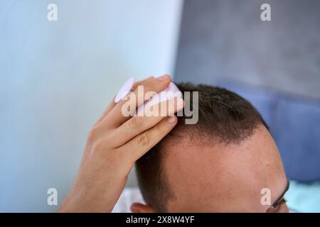 Ein Mann massiert seinen Kopf mit einem Massagegerät für Haarwuchs Stockfoto