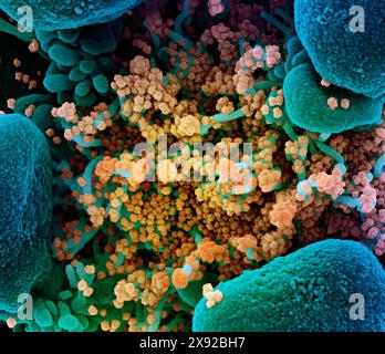 Kolorierter Rasterelektronenmikrograph einer apoptotischen Zellblau stark mit SARS-COV-2-Viruspartikeln gelb infizierten apoptotischen Zelle, isoliert aus einer Patientenprobe. Aufnahme in der NIAID Integrated Research Facility IRF in Fort Detrick, Maryland. Neuartiges Coronavirus SARS-CoV-2 016546 056 Stockfoto
