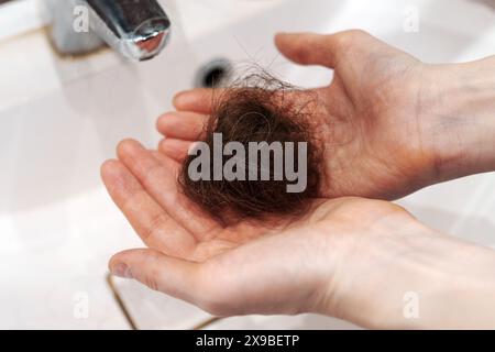 Viele Haarausfall auf Filter im Waschbecken im Badezimmer. Krank. Gesundheitskonzept. Stockfoto