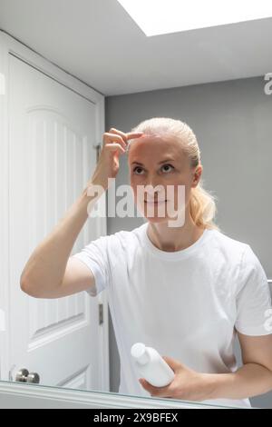 Caucasian Female wendet Feuchtigkeitscreme an, Creme auf Sonnenbrand auf der Kopfhaut, Stirn unter den Haaren im Badezimmer. Weiße Frau Leidet Unter Face Sun Burn, Die Hält Stockfoto