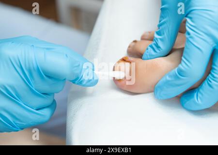 Nahaufnahme einer Frauenfüße nach podiatrischer Versorgung in der Klinik Stockfoto