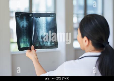 Arzt analysiert Röntgenbildgebung im Krankenhaus für eine genaue Diagnose Stockfoto