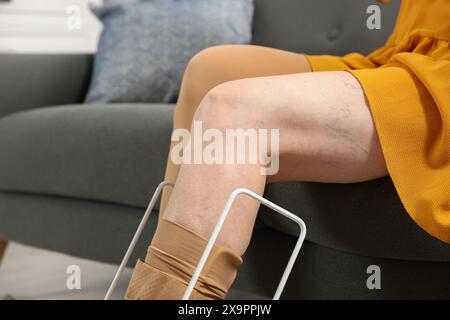 Frau in Kompressionsstrumpfhosen mit donner im Wohnzimmer, Nahaufnahme. Varizenprophylaxe Stockfoto