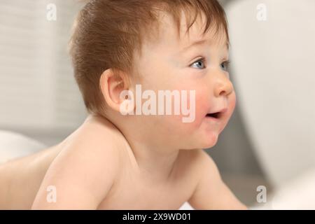 Süßes kleines Baby mit allergischer Rötung auf den Wangen drinnen, Nahaufnahme Stockfoto