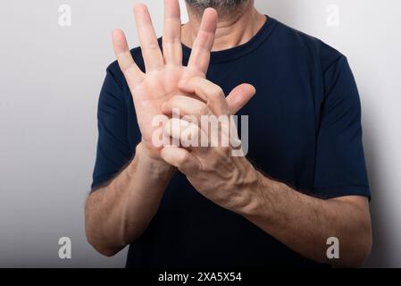 Mann mittleren Alters kratzt sich die Hand. Hautkrankheiten. Allergische Reaktion. Dermatologische Versorgung Stockfoto