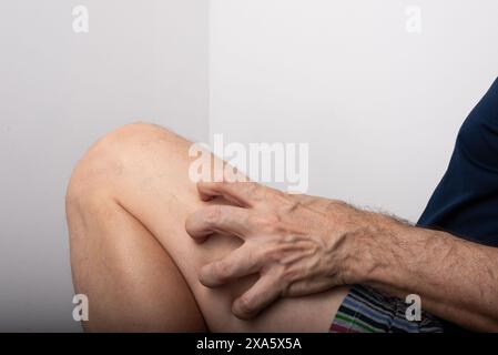 Mann kratzt zwischen Knie und Bein. Hautkrankheiten. Allergische Reaktion. Dermatologie. Isoliert auf weißem Hintergrund. Stockfoto