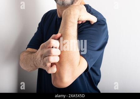 Mann mittleren Alters kratzt sich am Unterarm. Hautkrankheiten. Dermatologische Versorgung Stockfoto