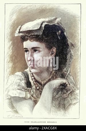 Clara Louise Kellogg ist eine US-amerikanische Opernsängerin, Opernsängerin, 1870er Jahre, Vintage illustraion, 19. Jahrhundert Stockfoto