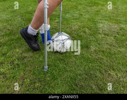 Junge mit gebrochenem Bein in einem Gips während eines Fußballspiels eine Verletzung eines jungen Athleten Stockfoto