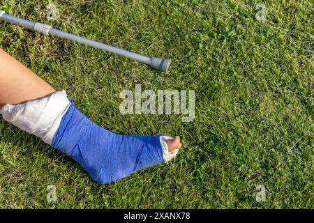 Junge mit gebrochenem Bein in einem Gips während eines Fußballspiels eine Verletzung eines jungen Athleten Stockfoto