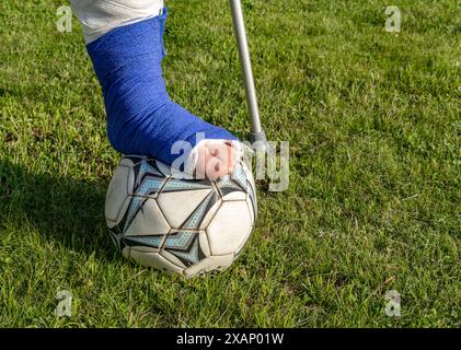 Junge mit gebrochenem Bein in einem Gips während eines Fußballspiels eine Verletzung eines jungen Athleten Stockfoto