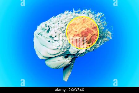 Gehirn von der Seite gesehen. Degenerative Erkrankungen. Degenerative Erkrankungen des Gehirns, Parkinson, Synapsen, Neuronen, Alzheimer, Krankheit, Konzept. 3D-Rendering Stockfoto