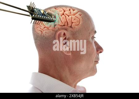 Installation elektronischer Chip in menschliches Gehirn, in verschiedenen Bereichen Neurotechnologie und medizinische Wissenschaft, Computer-Kontrollperson Stockfoto