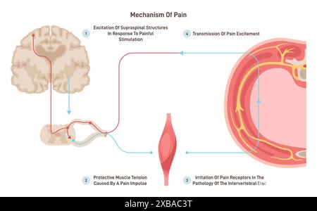 Anatomie und Physiologie des Schmerzes. ZNS-Reaktion oder Reflex bei schmerzhafter Stimulation. Neurologisches Wissenschaftsschema. Illustration des flachen Vektors Stock Vektor