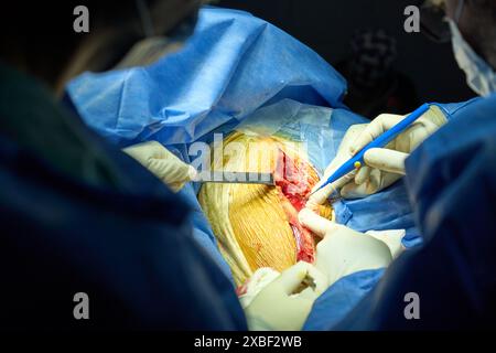 Chirurgen, die während einer Operation einen empfindlichen Schnitt durchführen Stockfoto