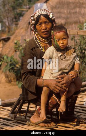 Akha Hill Tribe Indigene in Nordthailand 1995. Mutter und Sohn, das Kind ist unwohl ein Arzt der traditionellen Medizin hat einen Verband, einen natürlichen Umschlag an das Gesicht des Kindes gebunden. Sie trägt Trachtenkleidung Halskette Kopfschmuck in einem abgelegenen Dorf, bekannt als Akha Village Pala in den Bergen von Nordthailand. 1990er Jahre HOMER SYKES Stockfoto