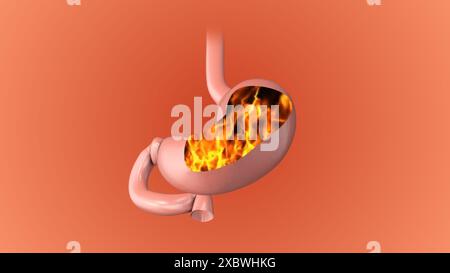 Magenschmerzen und Brennen Stockfoto