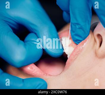 Zahnarzt, Mund und Hände für Zahnseide, Zähne und Reinigung oder Krankenversicherung im Krankenhaus. Nahaufnahme, Hygiene und Verfahren oder Operation mit dem Patienten Stockfoto