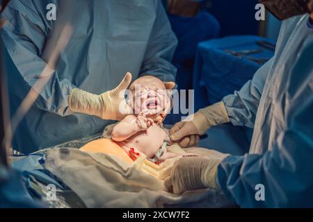 Ein Baby wird während eines Kaiserschnitts geboren. Der chirurgische Eingriff wird in einem sterilen Operationssaal mit einem qualifizierten medizinischen Team durchgeführt, um sicherzustellen Stockfoto