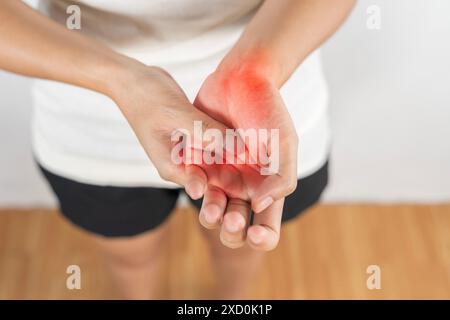 Eine Frau mit roten Händen und einem weißen Hemd. Die Frau hält ihre Hände hoch und hat eine rote Markierung am Handgelenk. Konzept mit Handarthrose Grimace bei PA Stockfoto