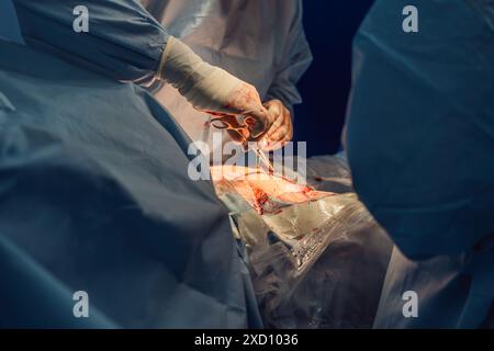 Zwei Ärzte führen eine Operation im OP durch. Die Chirurgen sind fokussiert und präzise, umgeben von fortschrittlicher medizinischer Ausrüstung. Steril Stockfoto