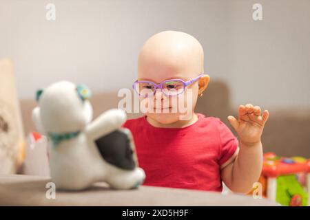 Kleines Mädchen mit Krebs und Haarausfall durch Chemotherapie. Internationaler Tag Des Krebses Im Kindesalter Stockfoto