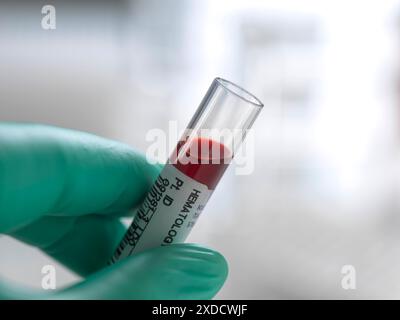 Wissenschaftler, der eine menschliche Blutprobe hält und für analytische Tests im Labor vorbereitet wird. Stockfoto