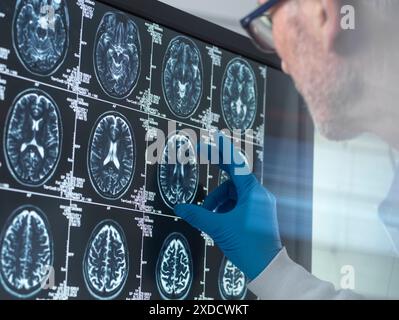 Wissenschaftler, die eine MRT (Magnetresonanztomographie) des Gehirns eines Patienten auf Alterung und Schäden durch Demenz und Alzheimer-Krankheit untersuchen. Stockfoto