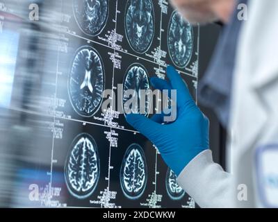 Wissenschaftler, die eine MRT (Magnetresonanztomographie) des Gehirns eines Patienten auf Alterung und Schäden durch Demenz und Alzheimer-Krankheit untersuchen. Stockfoto
