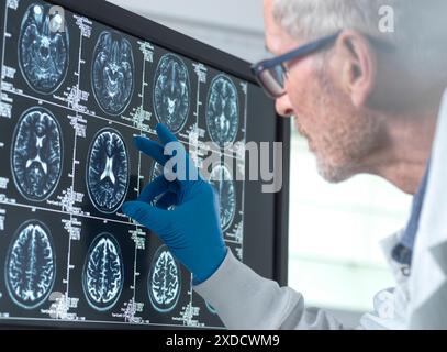 Wissenschaftler, die eine MRT (Magnetresonanztomographie) des Gehirns eines Patienten auf Alterung und Schäden durch Demenz und Alzheimer-Krankheit untersuchen. Stockfoto
