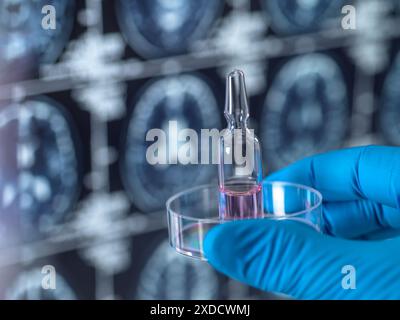 Wissenschaftler, der während einer klinischen Untersuchung vor einer MRT (Magnetresonanztomographie) des Gehirns eine mögliche Heilung für Demenz und Alzheimer-Krankheit vorstellt. Stockfoto