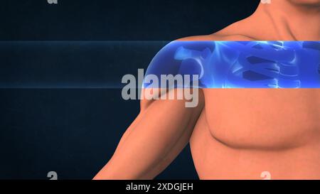 Ein Röntgenbild einer menschlichen Schulter Stockfoto
