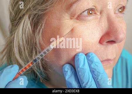 Nahaufnahme der Hände eines Kosmetikers, der Botox in das weibliche Gesicht injiziert. Stockfoto