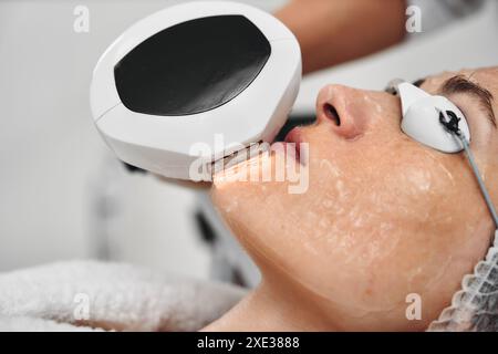 Eine Frau erhält eine IPL-Therapie in einem Schönheitssalon. Stockfoto