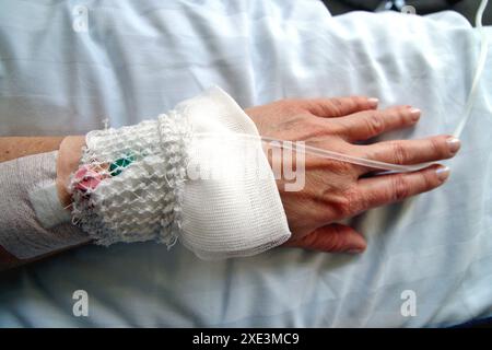 Patientin mit Infusionstropf im Krankenhaus. Arm der Frau, Hand des Patienten, Flasche mit Infusion in A Stockfoto