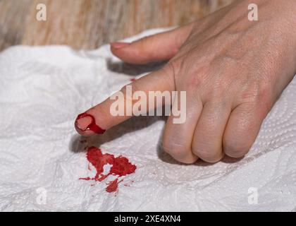 Die Hand einer Frau mit einem aufgeschnittenen Finger, die stark blutet. Stockfoto