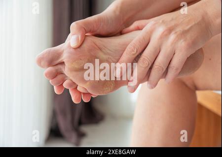 Schmutzige und vernachlässigte Füße, Pflege und Pediküre erforderlich Stockfoto