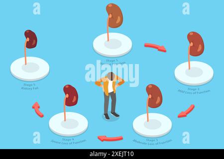 3D Isometrische flache konzeptionelle Illustration der Nierenerkrankung, Stadien der Niereninsuffizienz 3D Isometrische flache konzeptionelle Illustration Stockfoto