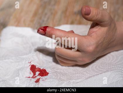 Die Hand einer Frau mit einem aufgeschnittenen Finger, die stark blutet. Stockfoto