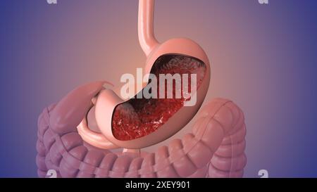 Die medizinische Animation der oberen gastrointestinalen Endoskopie Stockfoto