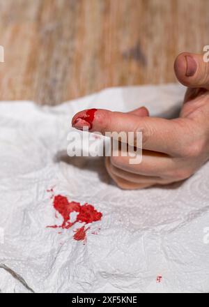 Die Hand einer Frau mit einem aufgeschnittenen Finger, die stark blutet. Stockfoto