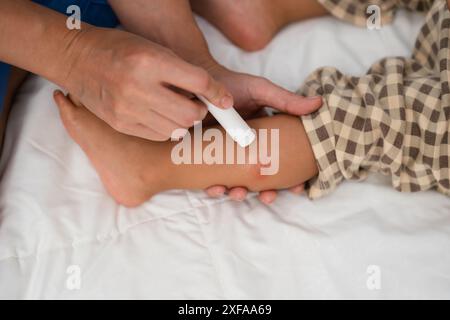 Mutter, die antiallergische Creme auf Allergie mit rotem Fleck am Babybein nach rotem Mückenbiss aufträgt Stockfoto