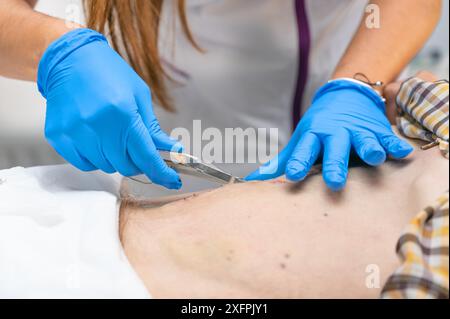 Pflegekraft nach chirurgischem Eingriff aus dem Abdomen eines Patienten. Hochwertige Fotos Stockfoto