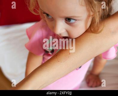 Kleinkind weiblichen beißen den Arm der Mutter. Kinder Gesicht Phasen des Wachstums, einschließlich Beißen. Stockfoto