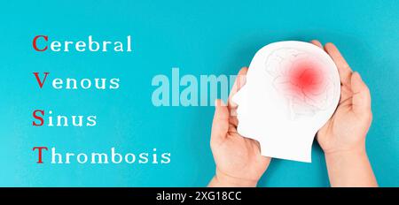 Zerebrale Venenthrombose steht auf dem Hintergrund, Silhouette eines Kopfes mit einem Gehirn, rotes Blutgerinnsel, Nebenwirkung covid-19-Impfstoff Stockfoto