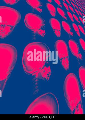 Farbige Röntgenbilder eines gesunden Schädels aus anteriorer (Front-) und lateraler (seitlicher) Sicht. Stockfoto