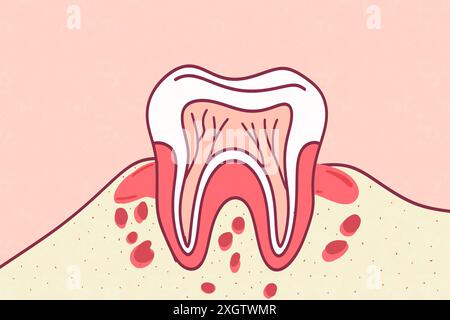 Detaillierte Darstellung eines menschlichen Zahnes im Querschnitt, der Schmelz, Dentin, Pulpa und eine Höhle zeigt. Ideal für Zahnerziehung und -Aufklärung Stockfoto