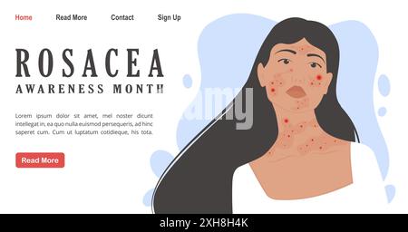 Frau mit Rosazea, Psoriasis Hautkrankheit Banner. April ist die Hintergrundvorlage für den Rosacea Awareness Month. Vektordarstellung einer geschorften weiblichen fa Stock Vektor